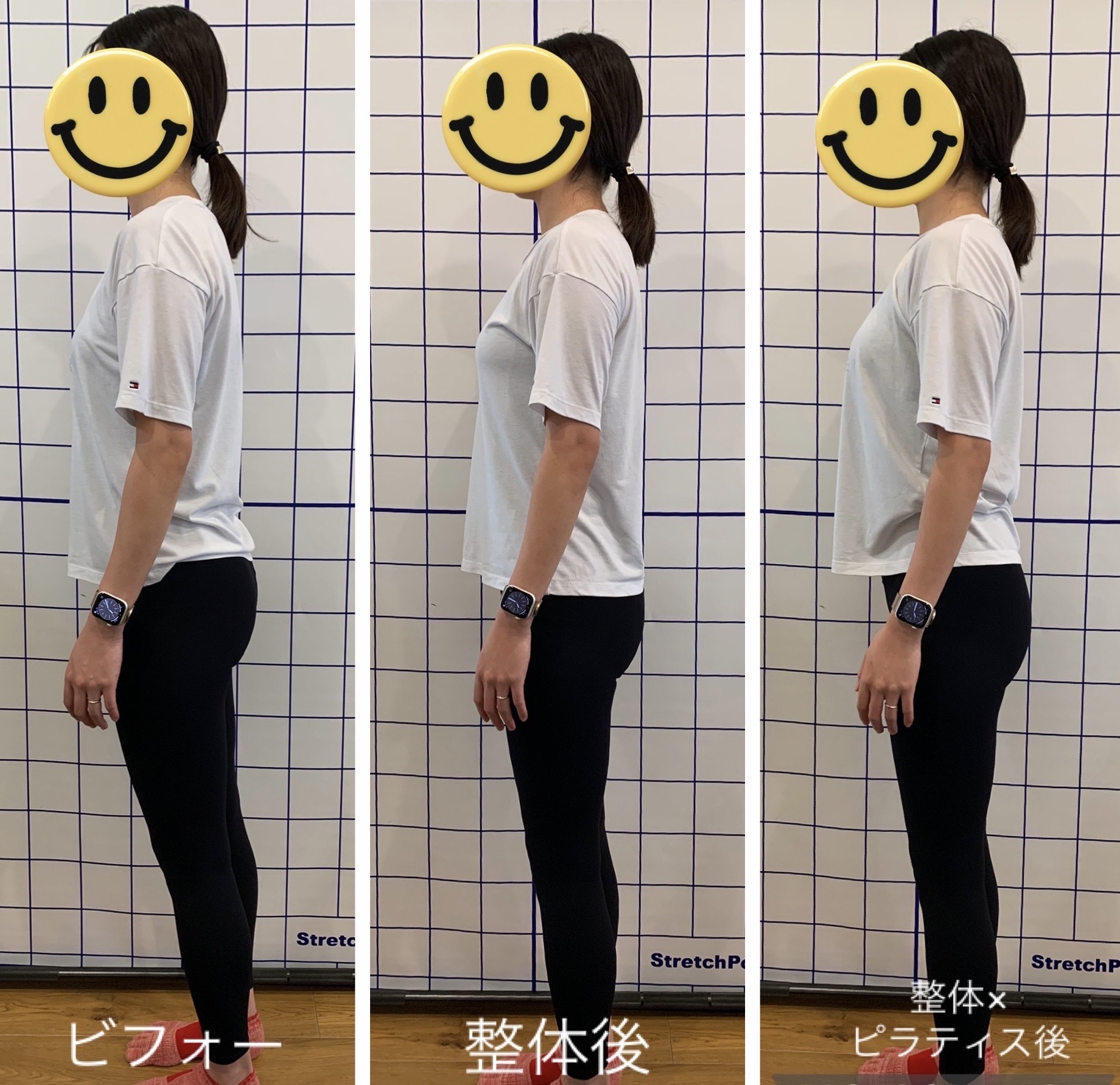 整体とピラティスによる姿勢変化